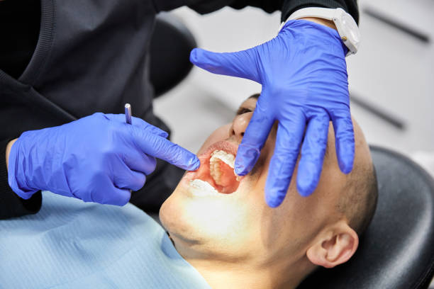 Best Emergency Dentist for Knocked-Out Tooth in Marble Falls, TX